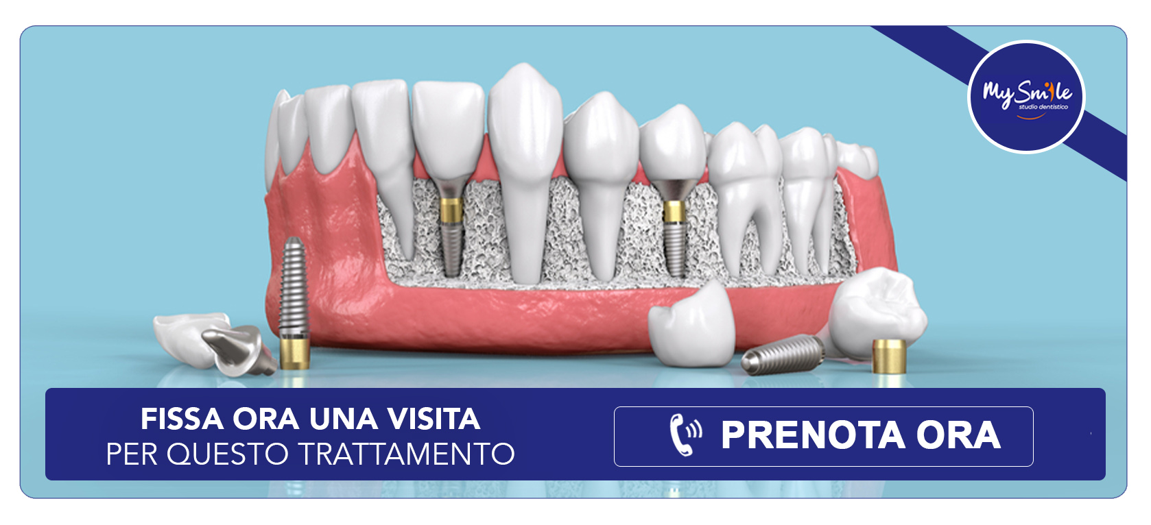 implantologia-dentale Settimo Milanese (Milano)