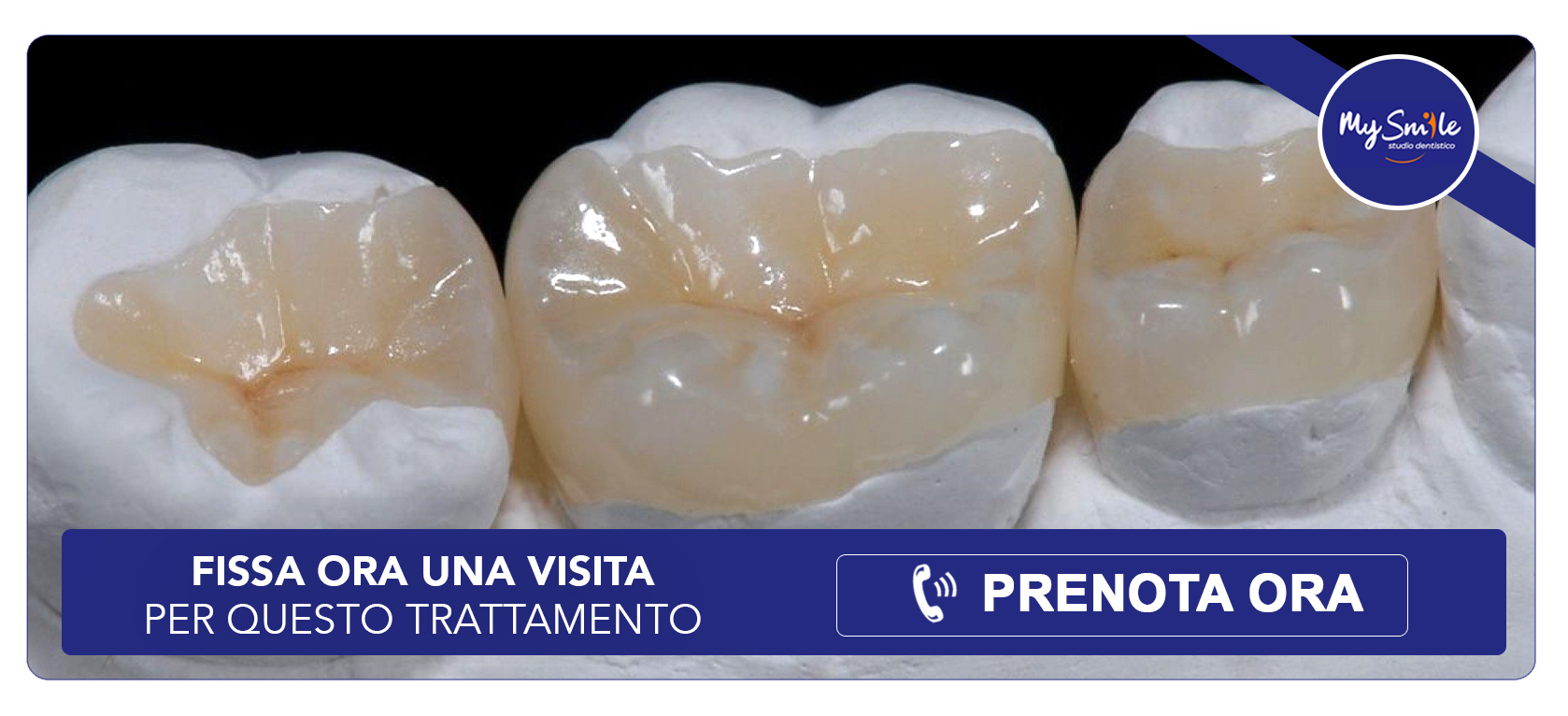 intarsio-dentale Settimo Milanese (Milano)